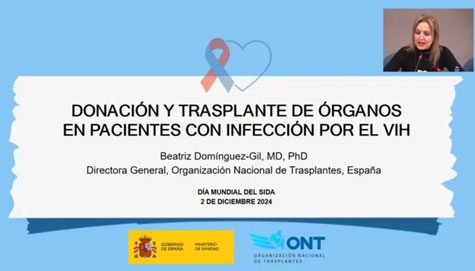 donacion organos VIH
