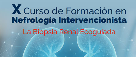 biopsia renal ecoguiada